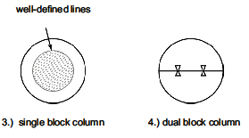 تجويف سطحي في الأعمدة المزدوجة
